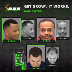 GROW Maximum XXL Hair & Beard Growth Accelerator - Serum Oil for Men - Fill Patches & Fix Thinning GUARANTEED - Facial Hair & Scalp Treatment - Thickening Conditioner & Enhancer - USA Made